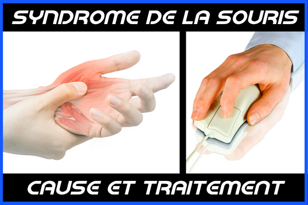 Le Syndrome de la Souris